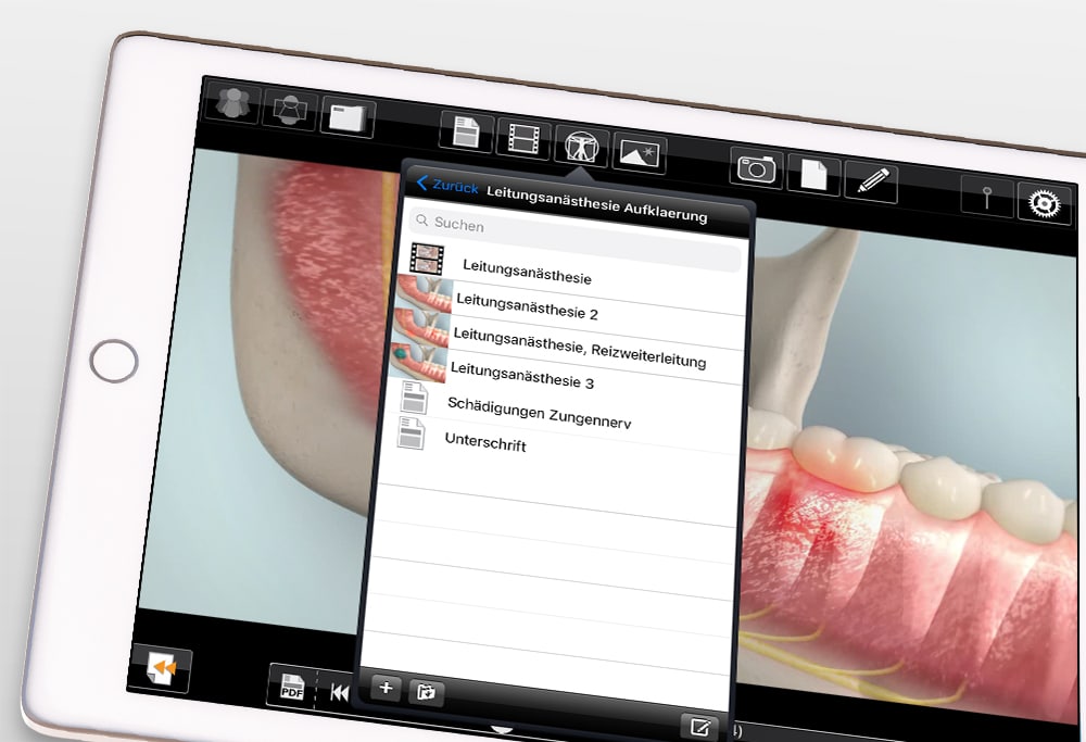 iPad mit infoskop zeigt die Aufklärung zur Leitungsanästhesie